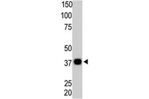 The PPP6C polyclonal antibody  is used in Western blot to detect PPP6C in Thymus tissue lysate. (PPP6C Antikörper  (N-Term))