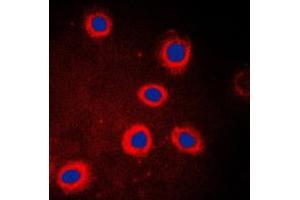 Immunofluorescent analysis of Adenylate Cyclase 9 staining in HeLa cells.