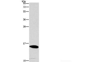Western Blot analysis of Mouse brain tissue using CST4 Polyclonal Antibody at dilution of 1:1450 (CST4 Antikörper)