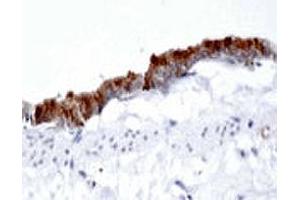 Immunohistochemistry using DAB substrate showing intense staining in the rat airway epithelium using AP1G1 polyclonal antibody  at a dilution of 1 : 500. (gamma 1 Adaptin Antikörper  (AA 5-24))