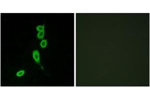 Immunofluorescence analysis of LOVO cells, using MSHR Antibody.