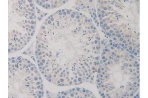 Immunohistochemistry (IHC) image for anti-Growth Differentiation Factor 5 (GDF5) (AA 358-495) antibody (ABIN7437095)