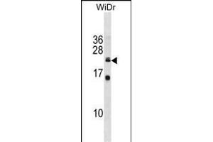 ISCU Antibody (C-term) (ABIN1881467 and ABIN2839004) western blot analysis in WiDr cell line lysates (35 μg/lane). (ISCU Antikörper  (C-Term))