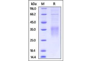 Mouse CD28, His Tag on SDS-PAGE under reducing (R) condition.