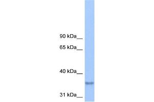 WB Suggested Anti-LPPR2 Antibody Titration:  0. (LPPR2 Antikörper  (Middle Region))