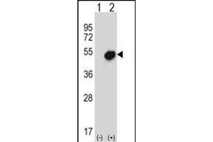 Western Blotting (WB) image for anti-Nuclear Receptor Subfamily 0, Group B, Member 1 (NR0B1) (AA 304-333) antibody (ABIN657696)