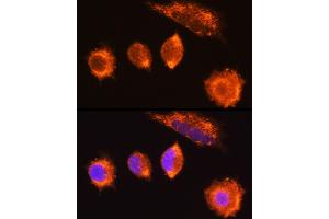 Immunofluorescence analysis of L929 cells using MG Rabbit pAb (ABIN6132348, ABIN6143808, ABIN6143810 and ABIN6222011) at dilution of 1:100 (40x lens). (MGAT1 Antikörper  (AA 156-445))