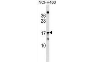 Western Blotting (WB) image for anti-Mitochondrial Ribosomal Protein S11 (MRPS11) antibody (ABIN2999548) (MRPS11 Antikörper)