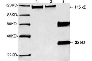 Western blot analysis of recombinant human Calcineurin A protein and mouse brain tissue lysate using 0. (Calcineurin A Antikörper  (N-Term))