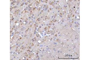 IHC analysis of RARS/RARS1 using anti-RARS/RARS1 antibody (ABIN7600223). (Probable Arginine--tRNA Ligase, Cytoplasmic (RARS-1) (AA 165-425) Antikörper)