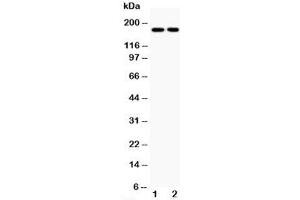 Western blot testing of Topoisomerase II alpha antibody and Lane 1:  HeLa;  2: Jurkat;  Predicted size: 174KD;  Observed size: 174KD (Topoisomerase II alpha Antikörper  (C-Term))