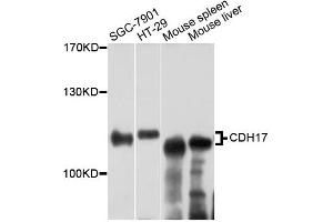 Western blot analysis of extracts of various cell lines, using CDH17 antibody (ABIN2561776) at 1:3000 dilution.