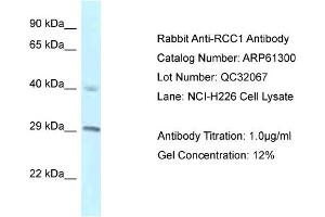 Western Blotting (WB) image for anti-Regulator of Chromosome Condensation 1 (RCC1) (C-Term) antibody (ABIN2788760) (RCC1 Antikörper  (C-Term))