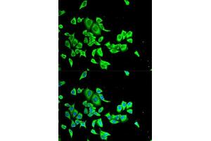 Immunofluorescence (IF) image for anti-serpin Peptidase Inhibitor, Clade B (Ovalbumin), Member 1 (SERPINB1) (AA 100-379) antibody (ABIN6147583)