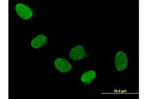 Immunofluorescence of purified MaxPab antibody to DDX5 on HeLa cell.