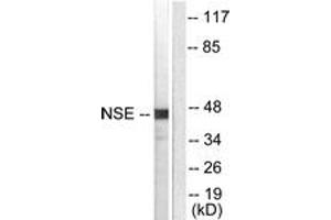 Western blot analysis of extracts from HepG2 cells, using NSE Antibody. (ENO2/NSE Antikörper  (AA 371-420))