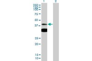 Western Blot analysis of PRKAR1A expression in transfected 293T cell line by PRKAR1A MaxPab polyclonal antibody. (PRKAR1A Antikörper  (AA 1-381))