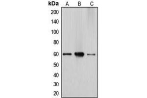 Western blot analysis of Cytochrome P450 27A1 expression in HepG2 (A), Caco2 (B), A549 (C) whole cell lysates.