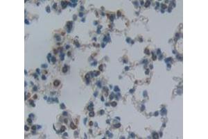 Used in DAB staining on fromalin fixed paraffin- embedded Kidney tissue (ITGA2 Antikörper  (AA 212-370))