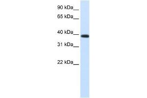 PTDSR antibody used at 0.