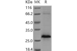 Western Blotting (WB) image for Ectodysplasin A2 Receptor (EDA2R) protein (His tag) (ABIN7321194) (Ectodysplasin A2 Receptor Protein (EDA2R) (His tag))