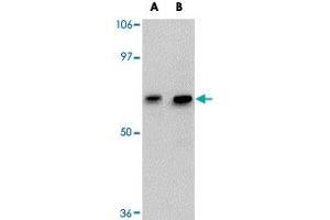 Western blot analysis of GALNT10 in SK-N-SH cell lysate with GALNT10 polyclonal antibody  at (A) 1 and (B) 2 ug/mL .