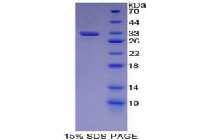 SDS-PAGE analysis of Mouse Cadherin 16 Protein.