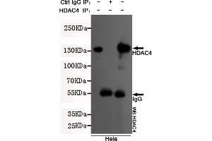 Immunoprecipitation analysis of Hela cell lysates using HDAC4 mouse mAb. (HDAC4 Antikörper  (N-Term))