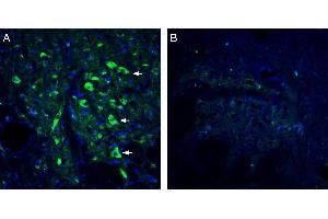 Expression of 5HT2A Receptor in rat dorsal raphe nucleus. (HTR2A Antikörper  (Extracellular))