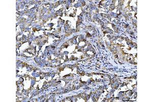 IHC analysis of CD147/Emmprin using anti-CD147/Emmprin antibody (ABIN7599999). (CD147 Antikörper  (AA 138-323))