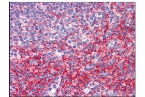 Human Spleen: Formalin-Fixed, Paraffin-Embedded (FFPE) (ATG9B Antikörper  (C-Term))