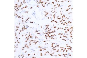 Immunohistochemistry (IHC) image for anti-SRY (Sex Determining Region Y)-Box 10 (SOX10) (AA 416-466) antibody (ABIN7454037) (Rekombinanter SOX10 Antikörper  (AA 416-466))