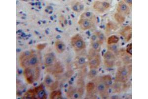 Used in DAB staining on fromalin fixed paraffin-embedded liver tissue (Aggrecan Antikörper  (AA 34-147))