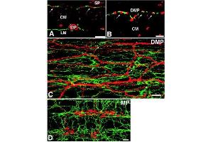 Double-labeling immunofluorescence for c-Kit and nitric oxide synthase (NOS) in the guinea-pig small intestine. (Meerschweinchen Serum Sterile)