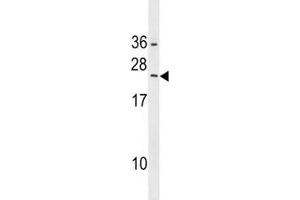 RAB5B antibody western blot analysis in HepG2 lysate. (RAB5B Antikörper  (AA 85-112))