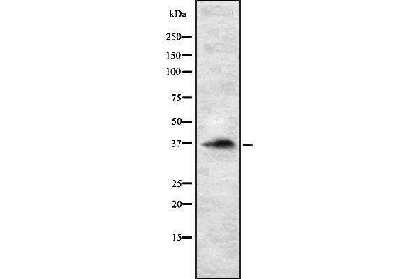 RASSF2 Antikörper  (Internal Region)