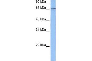 Western Blotting (WB) image for anti-TAF15 RNA Polymerase II, TATA Box Binding Protein (TBP)-Associated Factor, 68kDa (TAF15) (N-Term) antibody (ABIN2778851)