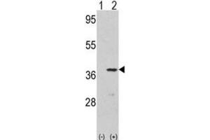 Western Blotting (WB) image for anti-Cyclin-Dependent Kinase 3 (CDK3) antibody (ABIN3003266) (CDK3 Antikörper)