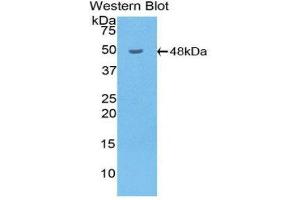 Western Blotting (WB) image for anti-Hyaluronidase-1 (HYAL1) (AA 52-462) antibody (ABIN3201924) (HYAL1 Antikörper  (AA 52-462))