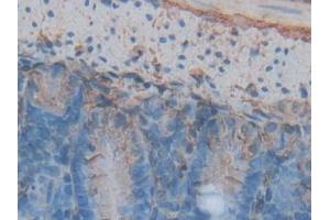 Immunohistochemistry (IHC) image for anti-Annexin A5 (ANXA5) (AA 1-319) antibody (ABIN1077800)