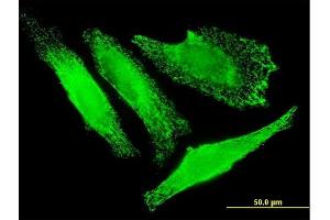 Immunofluorescence of monoclonal antibody to SLC25A20 on HeLa cell. (SLC25A20 Antikörper  (AA 1-301))