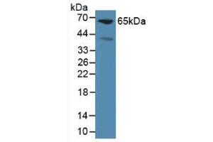Western blot analysis of Mouse Liver Tissue. (Glypican 3 Antikörper  (AA 344-559))