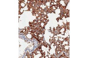 Immunohistochemical analysis of paraffin-embedded mouse lung tissue using (ABIN1539189 and ABIN2838276) performed on the Leica® BOND RXm.