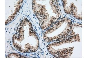 Immunohistochemical staining of paraffin-embedded Human Kidney tissue using anti-USP5 mouse monoclonal antibody. (USP5 Antikörper)