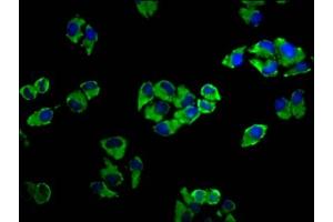 Immunofluorescence staining of Hela cells with ABIN7143330 at 1:33, counter-stained with DAPI. (ADCY5 Antikörper  (AA 584-719))