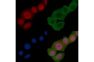 ABIN6255304 and ABIN6267326 staining Hela cells(24h of starvation treatment) by IF/ICC. (Tyrosine Hydroxylase Antikörper  (pSer40))