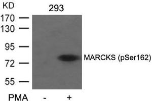 Western blot analysis of extracts from 293 cells untreated or treated with PMA using MARCKS(Phospho-Ser162) Antibody.