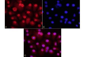HepG2 cells probed with Rabbit Anti-HURP Polyclonal Antibody (ABIN713861) at 1:200 for overnight 4C followed by Goat Anti-Rabbit IgG, Cy3 conjugated for 40 minutes, at room temperature. (DLGAP5 Antikörper  (AA 51-150))