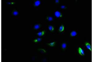 Immunofluorescence staining of A549 cells with ABIN7143175 at 1:166, counter-stained with DAPI. (Activin A Receptor Type IB/ALK-4 Antikörper  (AA 150-300))