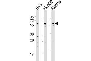 GRK5 anticorps  (C-Term)